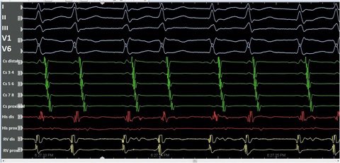 色々自粛中復活🌟 tweet media