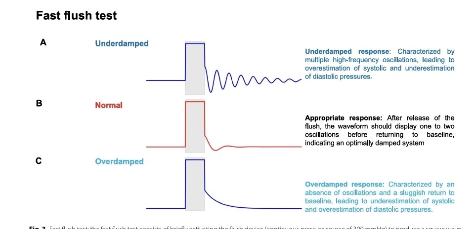 LeslieMegom's tweet photo. 🫀🧠🫁Fisiología aplicada a la cabecera del paciente: uso de la presión arterial invasiva como una verdadera herramienta de monitorización 🧐
📝Notas  y perlas 💎cafeteras ☕️ 
1️⃣📈La línea arterial no es un monitor de presión🔍: Es un monitor de fisiología
👀Si sólo miras la MAP, estás desperdiciando >70% de la información.‼️
💎  > Perla: una MAP “normal” puede coexistir con hipoperfusión severa si se sostiene a costa de vasoconstricción extrema o taquicardia.🫀
🔰Se propone dejar de ver la presión arterial invasiva (PAi) como un “número de seguridad” (p. ej., MAP ≥ 65 mmHg) y usar cada componente de la curva arterial presión arterial sistólica (SAP), Presión Arterial Diastólica, MAP y Presión de pulso como un monitor fisiológico dinámico para diagnosticar el fenotipo🤗 hemodinámico y ajustar 💧líquidos/vasopresores “en tiempo real”. ⏰️
🔍Reconocer artefactos clásicos:
⬇️🫀Underdamping → sobreestima SAP, subestima DAP, aumenta PP.
⬆️🫀Overdamping → subestima SAP, sobreestima DAP, “aplana” la curva.
💎Perla práctica: una decisión de líquidos,  escalamiento de vasopresores basada en una curva sobreamortiguada/subamortiguada es, literalmente, fisiología “sobre datos falsos”.
🔰A) MAP: presión de perfusión “macro”, pero no suficiente por sí sola
▶️MAP se mantiene como objetivo clínico sin embargo aislada  no identifica el mecanismo (↓CO vs vasoplejía) ni garantiza perfusión microcirculatoria. ‼️
🫀Subir PAM no siempre mejora perfusión si se hace sólo aumentando RVS.
🫀Una PAM “aceptable” puede ocultar: 
▪︎Bajo GC
▪︎Isquemia microcirculatoria
▪︎La línea arterial ayuda a inferir qué componente está fallando:
●DAP baja → RVS baja
●PP estrecha → GC bajo
●Perla de oro💎: antes de subir vasopresor, hay que preguntarse 🤔
👉 ¿la PAM está baja por bajo flujo o por bajo tono?🎯
🔰B) PAD presión arterial diastólica: el “termómetro” del tono vasomotor (y del tiempo diastólico)🫀
▪️ PAD  se interpreta como reflejo de tono arterial y con implicaciones directas para iniciar vasopresor temprano en vasoplejía. 
🔰La FC modifica PAD (diástole más corta puede elevar PAD aún con tono similar); por eso PAD aislada puede engañar si no se integra con FC. 🫀
🔰C) DSI (Diastolic Shock Index): HR/DAP para “detectar” vasoplejía grave y riesgo
🔶️DSI = FC / PAD se presenta como un marcador más robusto de tono vasomotor que PAD.🎯
☠️Se asocia con mortalidad y su desempeño se reporta comparable a SOFA/lactato y superior a MAP o “choque index sistólico”, además de identificar pacientes que se benefician de norepinefrina temprana. 💉
📝si PAD está baja y la FC alta (DSI alto), el fenotipo sugiere vasoplejía significativa → vasopresor TEMPRANO 💉
🔰VNERi: ▪️🫀Relación entre la presión arterial diastólica ajustada y la mortalidad en pacientes con choque  séptico.🧮
🫀▪️El choque séptico se asocia con la reducción del tono vasomotor y la hiporresponsividad a la norepinefrina .
🫀▪️VNERi puede guiar estrategias terapéuticas en casos de hipotensión persistente a pesar del tratamiento con NE.
🫀▪️VNERi mostró la asociación más fuerte con la mortalidad en comparación con otros índices.
♦️La Fórmula VNERi : (VNERi = TAD/(dosis NE x FC))
🔰La fórmula: TA Diastólica / (dosis de Norepinefrina x FC)
♦️Predice la mortalidad en pacientes con choque séptico un punto crítico en < 6.7.
🔰PP (Presión de pulso): Aproximación de volumen sistólico y herramienta para líquidos💧💧
●PP se discute como sustituto de volumen sistólico (SV) y como variable útil para “leer” la interacción corazón–arteria, con especial interés en reanimación del choque 🎯
●PP/PPV sólo son interpretables si: señal confiable, condiciones ventilatorias adecuadas, ritmo regular, sin gran esfuerzo inspiratorio espontáneo, etc.
●Cambios dinámicos (p. ej., durante elevación pasiva de piernas o maniobras ventilatorias) pueden ser más informativos que un valor aislado. animación fisiología-dirigida:
🎯MAP como objetivo macro de perfusión.👇🏽👇🏽
