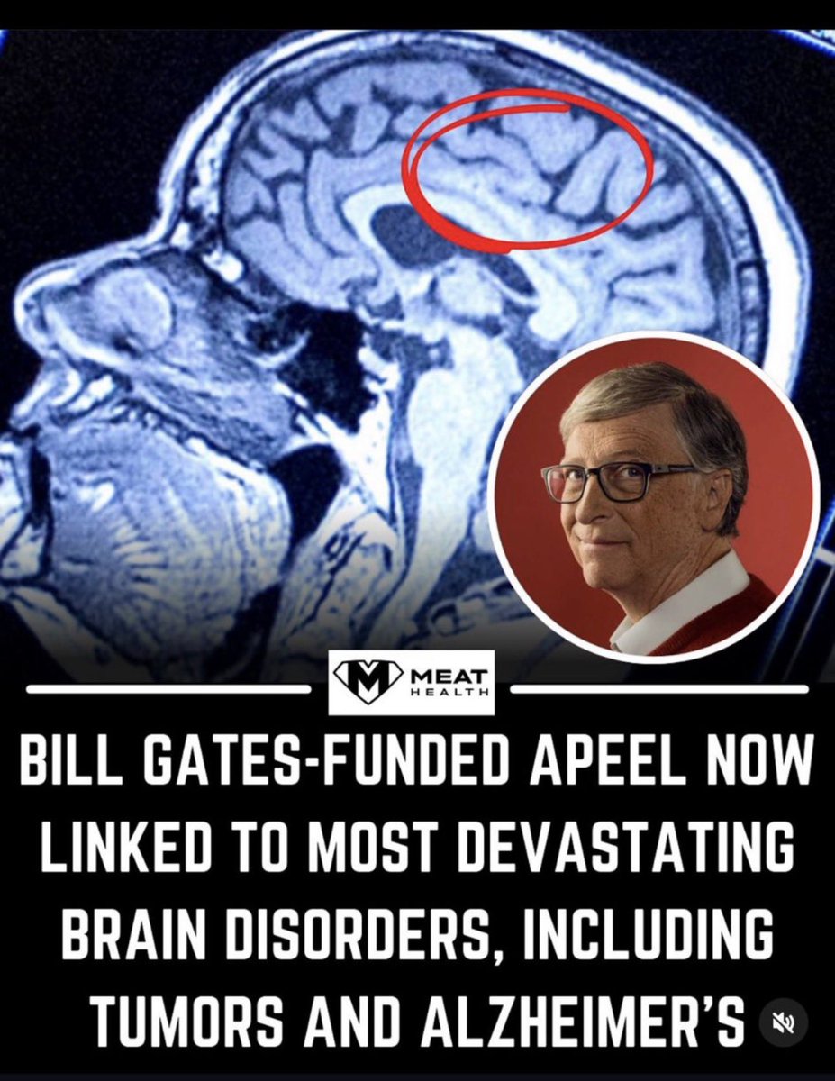BGatesIsaPyscho's tweet image. First Bill Gates started murdering Cows with Bovaer and now he’s inflicting Alzheimer’s on humans with his latest product ‼️