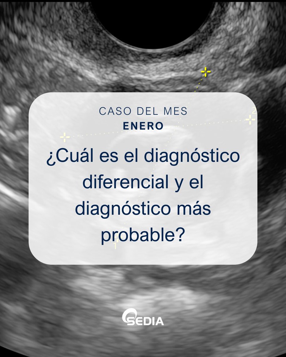 sediabdomen's tweet photo. 🩻 Caso del Mes SEDIA (enero)
Participa y opta a una inscripción gratuita al Congreso SEDIA 2027.

https://t.co/t9ABNlz3cN

Caso realizado por el Dr. José Vizuete del Río (H. U. Dr. Peset, Valencia).

#SEDIA #Radiología #CasoDelMes #CongresoSEDIA #Radiology https://t.co/5iF8lhTOeF