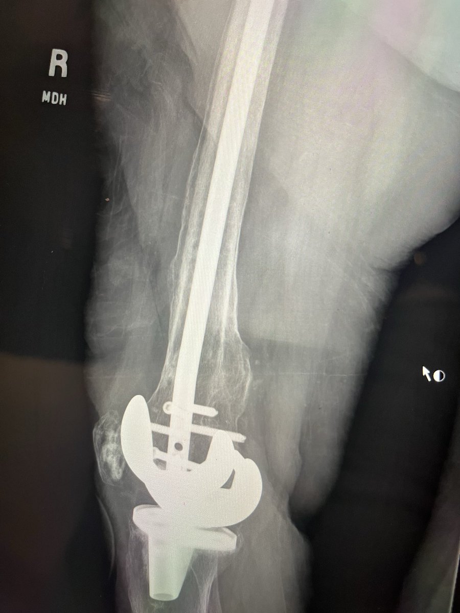 Broken Bone Doc tweet media