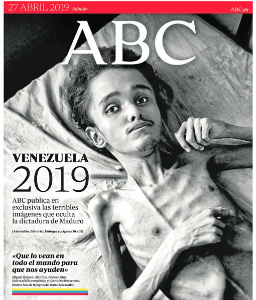 El testaferro de Maduro, Alex Saab, se lucraba con el saqueo del programa de ayuda alimentaria CLAP. En 2019 el ABC publicó esta portada de mis compañeros Ybarra y Benezrra. Salieron del chavismo a decir que era Yemen o no se qué. Pero no, se negaban a ver los efectos del régimen