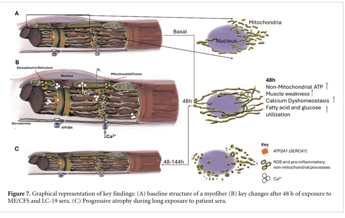 vipintukur's tweet image. Recent research demonstrates that sera from individuals with ME/CFS and #LongCOVID directly impair healthy skeletal muscle, reducing contractile force, inducing mitochondrial stress, and causing structural damage. 

➡️ These findings implicate circulating blood-borne factors as…