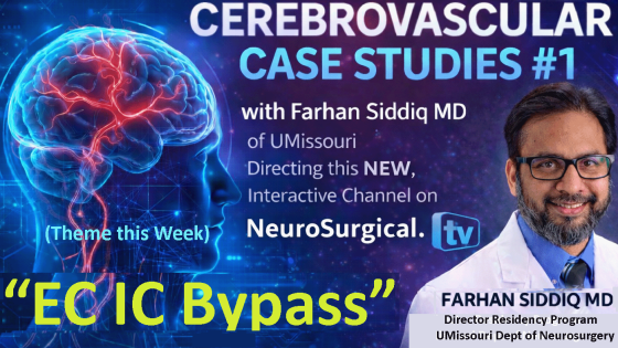 NeuroSurgTV's tweet photo. IN A FEW HOURS............LIVE..........8 AM EST, 7 am CST  https://t.co/3Di286Rlj5                Sunday  January 18, 7 am EST
 Cerebrovascular Case Studies #1, with Farhan Siddiq MD ,
“EC IC BYPASS”
ZOOM REGISTRATION: https://t.co/SPER5tXJT5 https://t.co/ewcG7Syki9