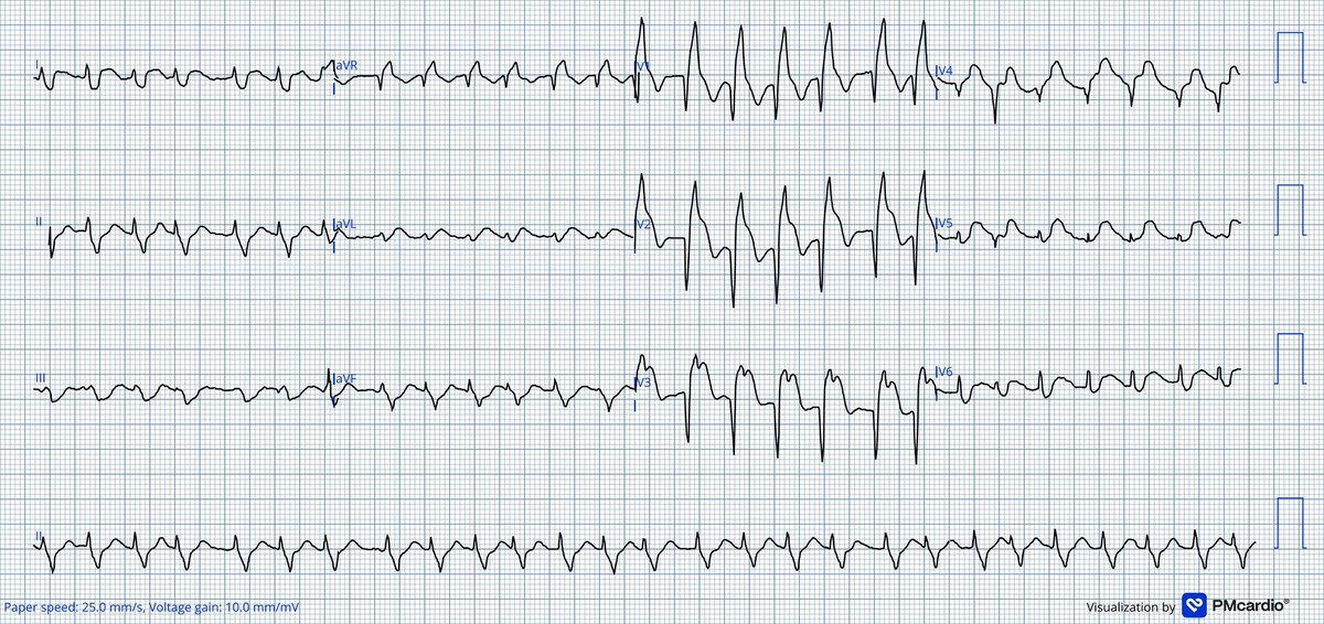 Cesar Salinas tweet media