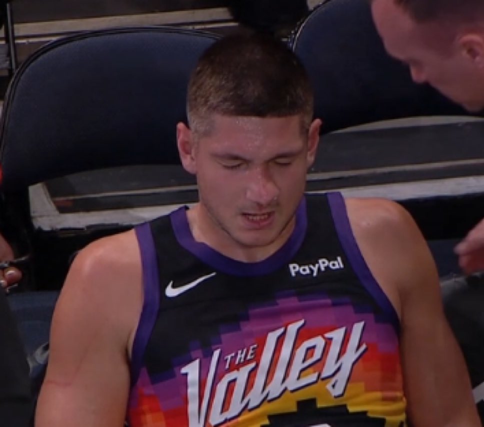 OG just broke Grayson Allen’s nose?