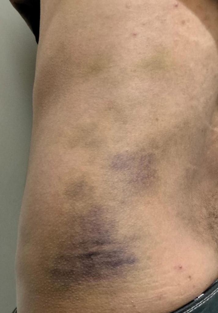 cuartodemillamx's tweet image. Hola buenas noches pido de su apoyo para poder compartir ya que vi una publicación y reconocí a estos ministeriales @FiscaliaEdomex (la foto la tomé de unas de tus mismas publicaciones  ya que no tuvimos oportunidad de grabar pero los reconocemos ) .

Hace un mes fuimos víctimas…