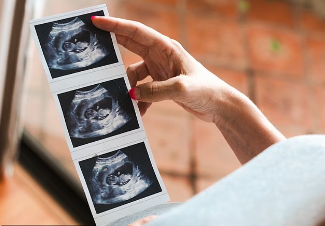 🚨NHS MIDWIVES ORDERED TO STAY SILENT AS COUSIN MARRIAGES FLOOD HOSPITALS WITH DEFORMED AND DYING BABIES!

Woke bosses admit the practice doubles the risk of horrific birth defects and infant deaths – yet ban staff from warning couples.

"Stigma hurts feelings more than genetic