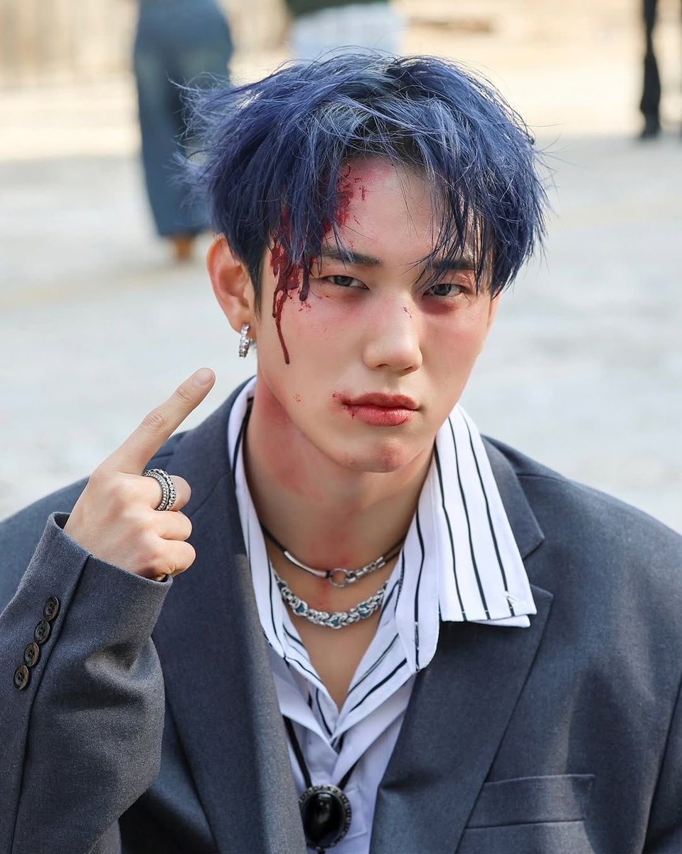 intak always looks like he got beat the fuck up in mvs whos he pissing off this much