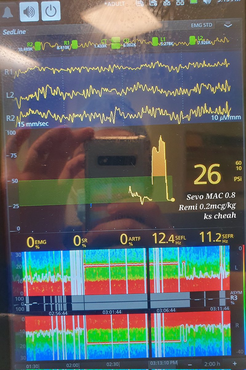 Kean Seng Cheah tweet media