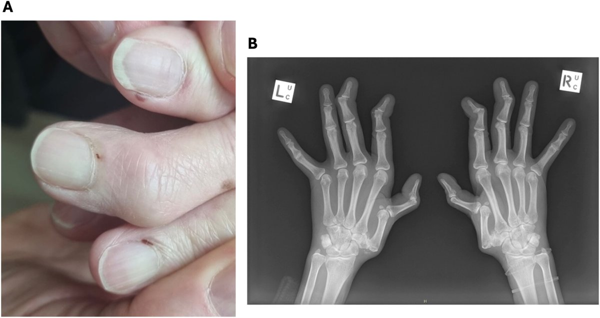 ACR_Journals tweet media