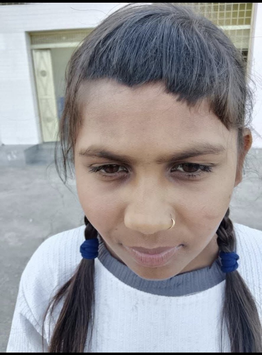 #हितेश्वरी_निनामा_को_न्याय_दो
देवदासी प्रथा बेशक खत्म हो गई हो लेकिन उसके अपवाद आज भी जिन्दा है!
शायद यही वजह है की...

समंत भद्र विद्या विहार स्कूल एवं कॉलेज हिमवन,धरियावद,प्रतापगढ़ (राजस्थान)
आदिवासी छात्रा हितेश्वरी निनामा को अपमानित और बाल काटने की घटना शर्मनाक है