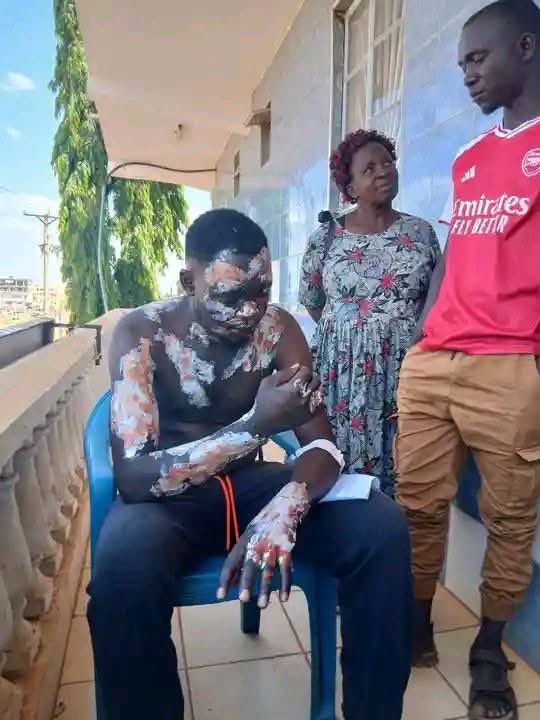 Just because he was burned with hot water by a woman, he will not receive the kind of help and justice a woman would have received if the roles were reversed. Gentlemen, you’re on your own.