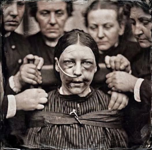 เรื่องราวของ "อลิซ ธอร์นตัน" เธอถูกจับในปี 1913 ในข้อหาขว้างก้อนหินใส่หน้าต่างรัฐสภา ข้อเรียกร้องของเธอคือ การให้สิทธิออกเสียงแก่ผู้หญิง โทษของเธอคือจำคุกหกเดือน

เธอประท้วงการอดอาหารโดยการอดอาหาร การตอบโต้ของเรือนจำนั้นโหดร้ายมาก พวกเขาบังคับให้เธอกินอาหารวันละสามครั้ง