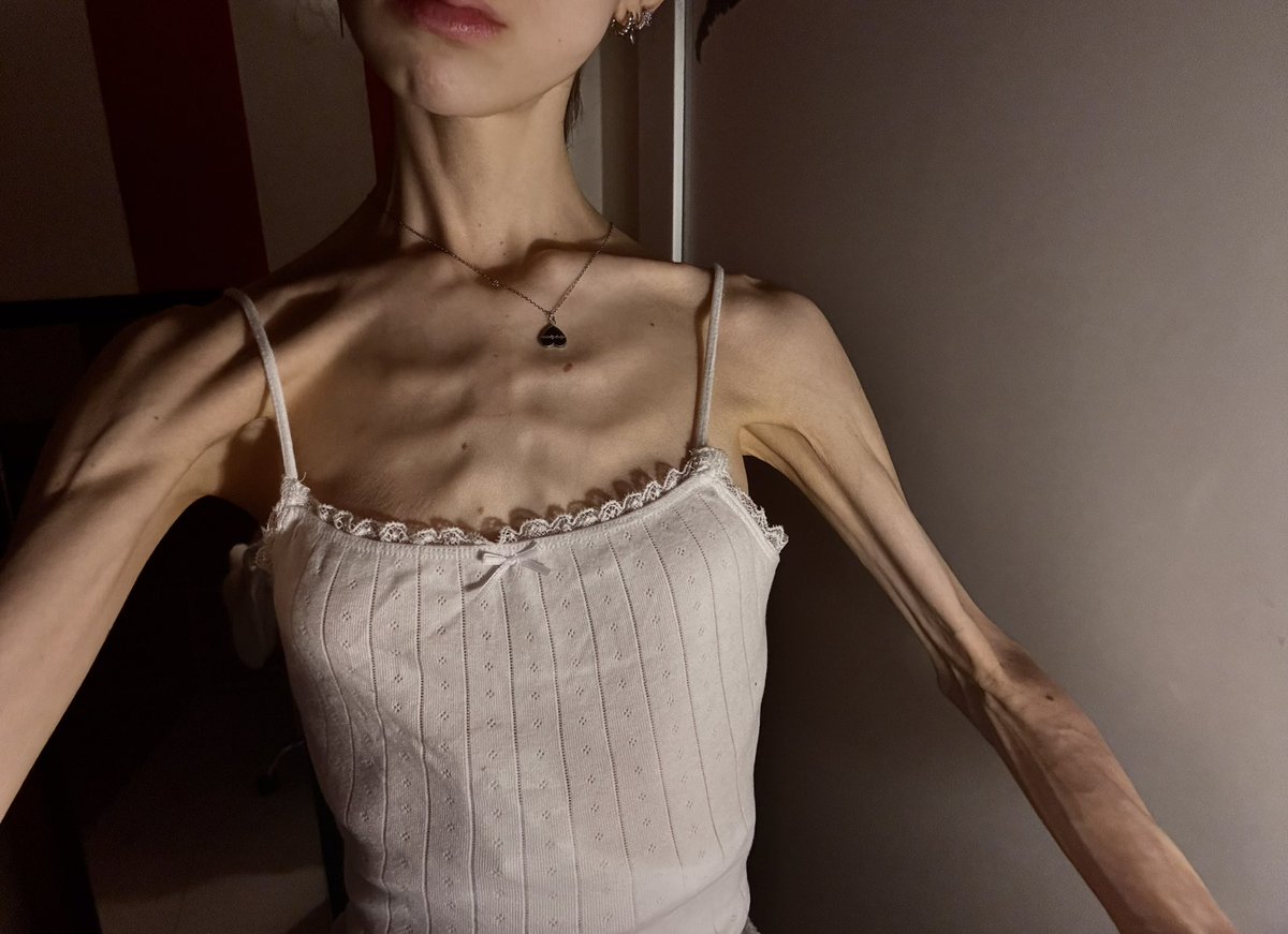 chlonorexic's tweet image. what’s the point in living i’m tired