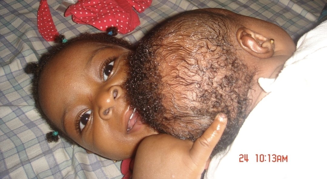 ndukaomeife's tweet photo. Sometimes in October 2007. Around 8:00pm.

I was at home with my two babies taken care by sister in-law, my wife' friend, Thomas, and Yinka. My wife had gone to work. She was a nurse on night duty.

We were in the sitting room. Thomas was playing with my new first laptop.

Unaware that eternity was about to brush past my life.
Suddenly, an unusual urge to pray came over me.

Not a normal thought.
Not a casual reminder.
A strong, unexplainable pull.

I had never felt anything like it before.
I excused myself from the sitting room and went into the children room's to pray.

About five minutes later, I heard raised voices.

An argument.

I wondered, Who is Yinka arguing with?

Before I could process it, the leader of the gang shouted and demanded to see the owner of the house.

At that moment, I understood: God had moved me out of harm’s way.

I hid behind the door.

One of them entered the room carying a shakabula, a locally made dane gun.

My heart almost stopped.

He bent down, picked my phone from the bed, and scanned the room.

Then the shouting intensified.
They began to manhandle Yinka in the sitting room. He seems to be arguing with them.

They were armed robbers.

I could no longer hide.
I surrendered myself.

They pointed the gun at me.
“Where is the gold? Where is the money? I will shoot you.”

Another group dragged in the landlady and her boyfriend.

We were beaten.
Humiliated.
Terrified.

They ransacked every wardrobe, took valuables, and left nothing untouched. My first laptop, gone too.

Finally, they locked all of us inside the bedroom.

That night passed, but the trauma did not leave with them.

Even after we moved to a new house, the fear followed me.

At night, I would wake up repeatedly to check the doors.
Even on the third floor.
Even when there was no logical reason. The trauma was there till I relocated.

But with time, understanding came.
That strange urge to pray was not random.

It was divine intervention.
A whisper from God saying, “Come aside. Let Me shield you.”

I may not understand all that happened that night,
but I know this:
👉 Prayer saved me before danger announced itself.
👉 God speaks before the storm arrives.
👉 Obedience, even when it doesn’t make sense, can be the difference between life and death.

Some traumas fade slowly,
but testimonies last forever.

And till today, I know,
I am alive because heaven intervened. 🙏🏾.

*Picture of my two babies at three months before the robbery.
