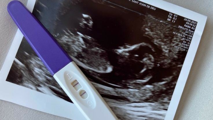 Bybiyours's tweet image. a #dewtee au, an actor and a lawyer
— hitam di atas putih dalam kontrak antara Sean Arshaka dan Gamaliel Charleston

; Part 11