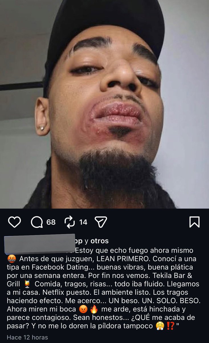 Pao_Glez01's tweet image. Veamos este caso: