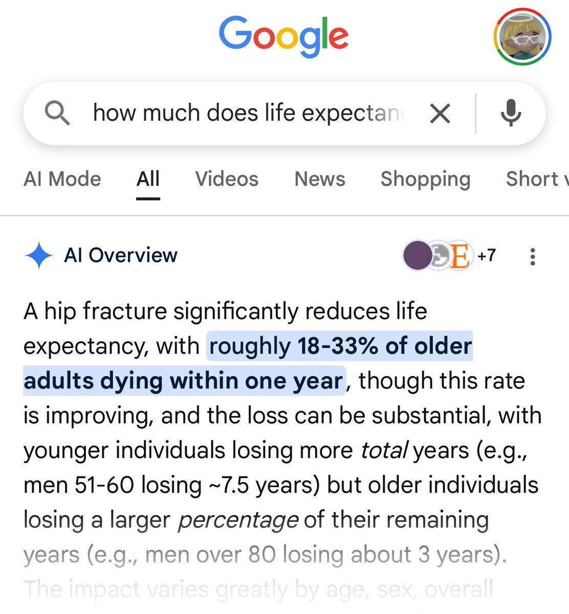 Hip fractures should scare the FUCK out of you if you’re getting old. 

As you get older if you don’t strength train your bones start withering away

A fracture makes you bed bound

Many elderly already suffering from sarcopenia lose the ability to walk after hospital discharge