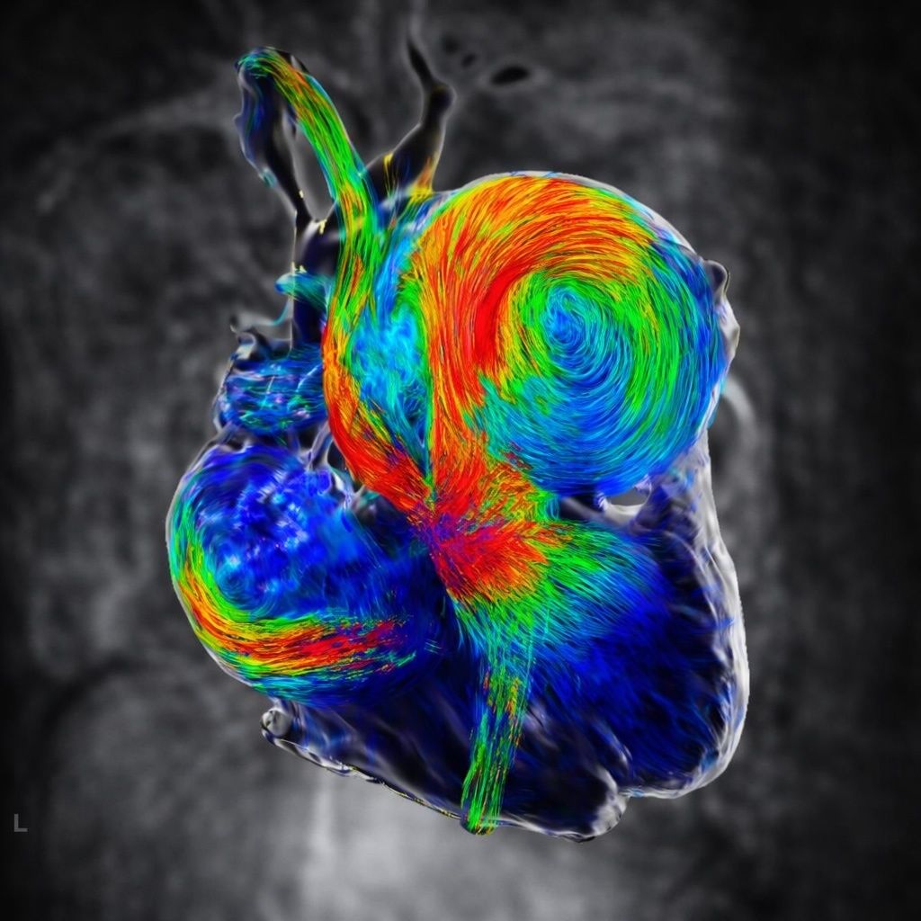 La Imagen + Bella 2025 - Proclamación del Ganador
Medalla de Oro - Ganador 🥇
17 - José Martín Alanís-Naranjo
Vortex pulmonalis aquarellae
🖼️ buff.ly/sabUORf ◀️