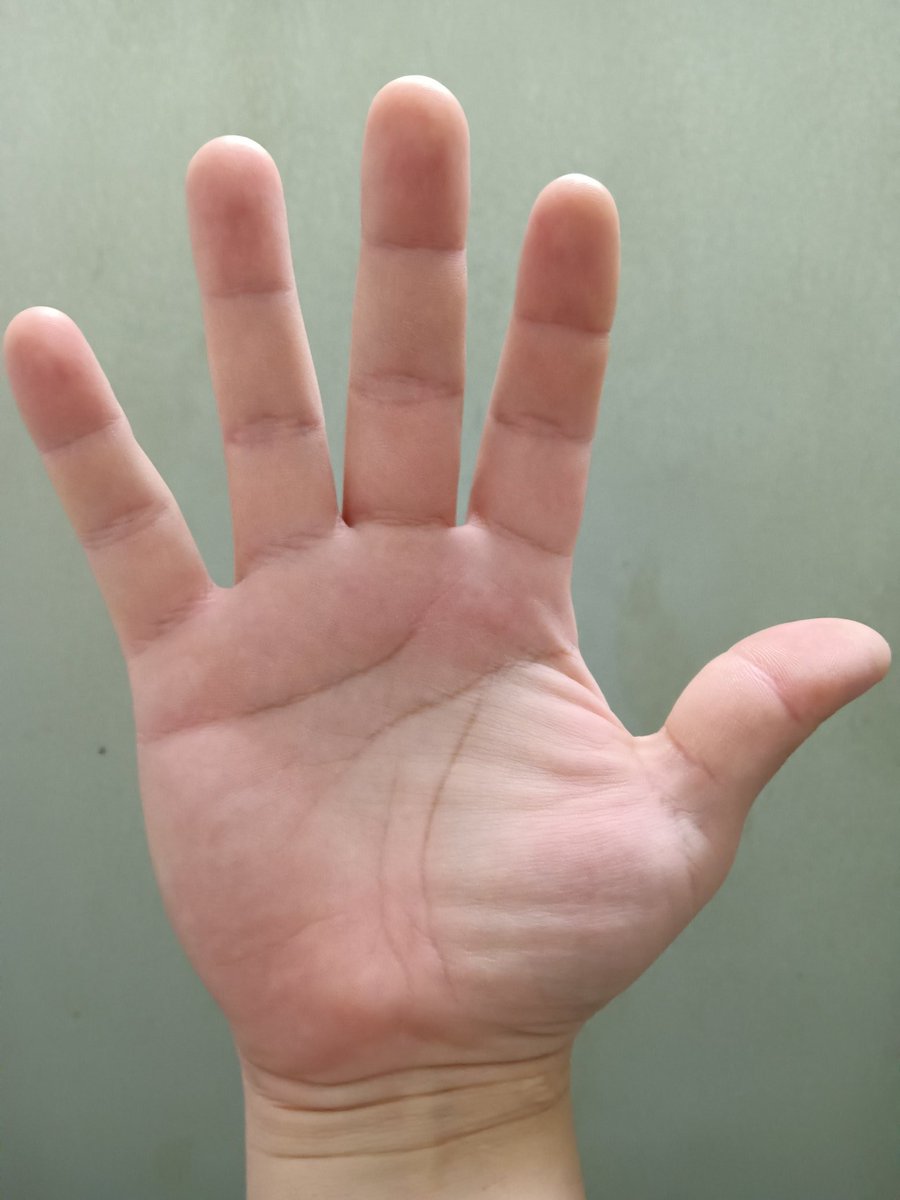 NightcoderND's tweet image. I don’t believe in destiny.

But it is funny that my palm lines form a π, and I spend my life chasing patterns, edge cases, and systems that never quite repeat.

Pareidolia?

Zoom in. Tell me what you think.