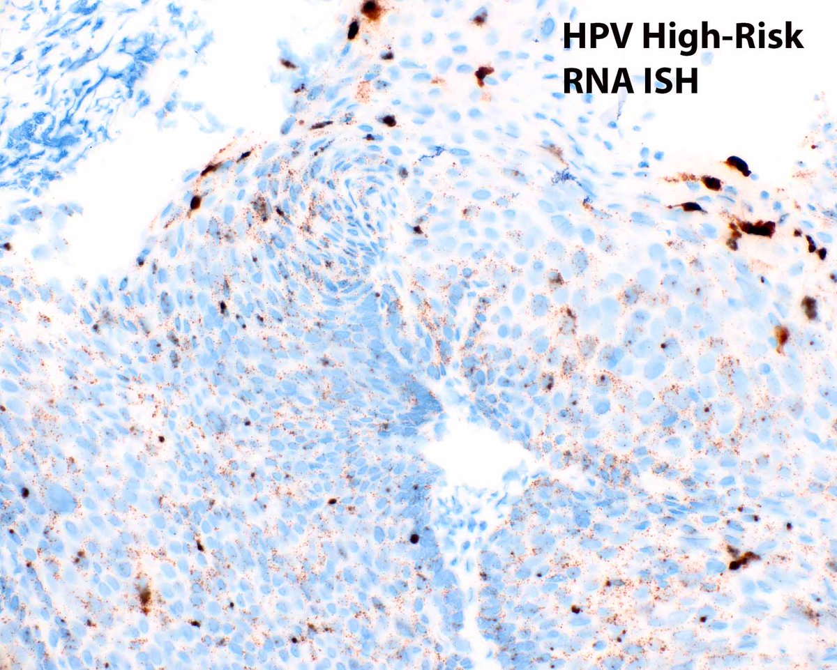 Modern Pathology tweet media