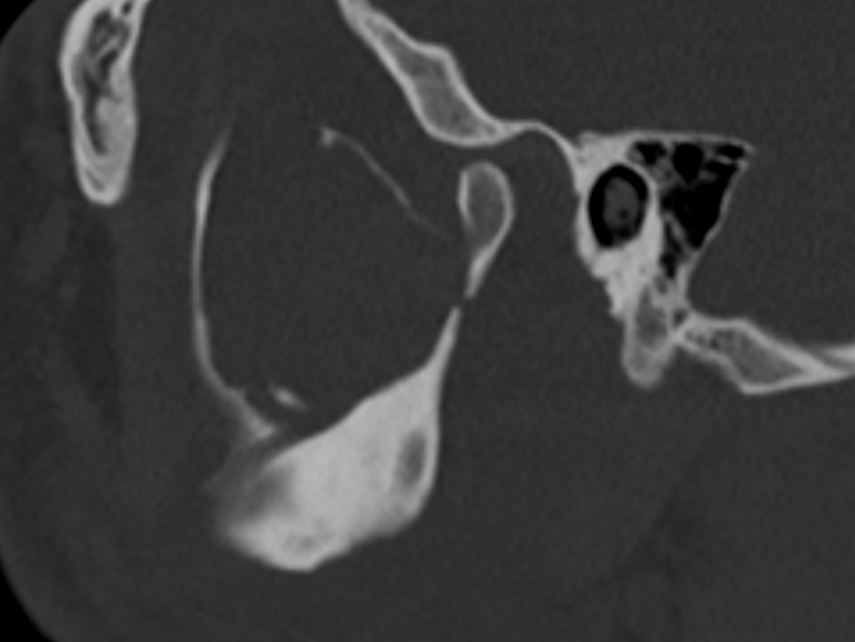 Jack Garnham tweet media