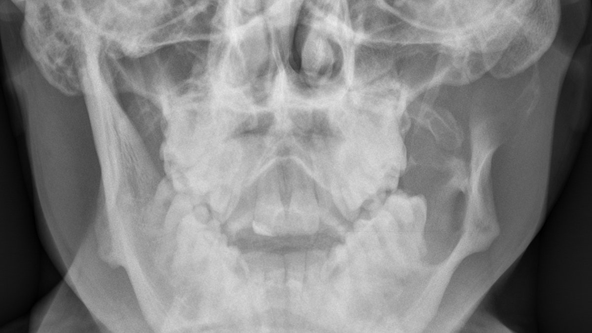 Jack Garnham tweet media