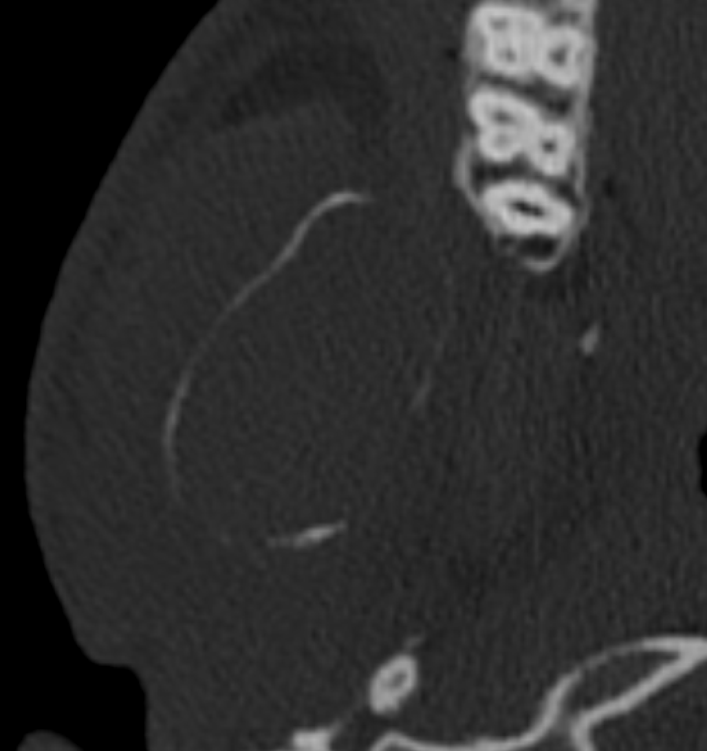 Jack Garnham tweet media