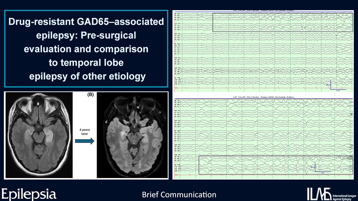 Epilepsia tweet media