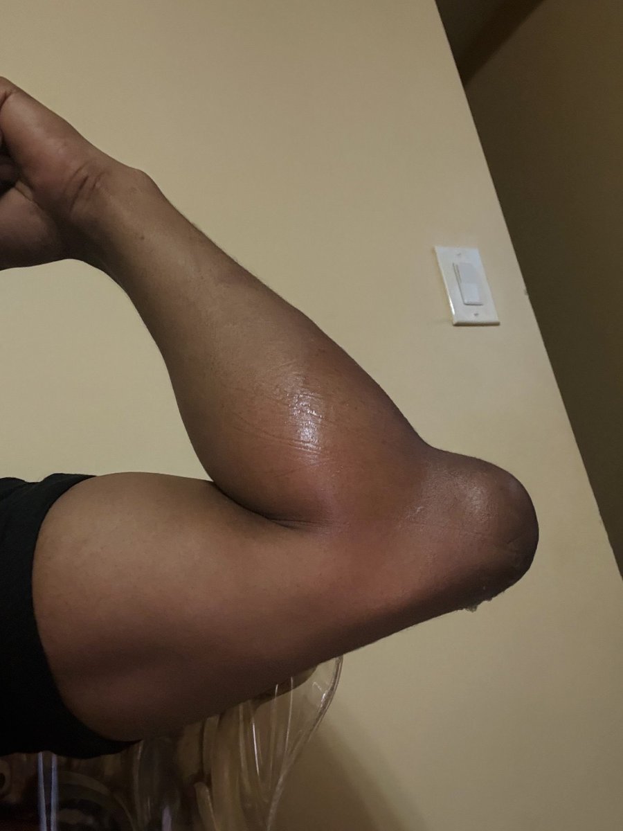 ReddCinema's tweet image. The funniest shit happened to me last night