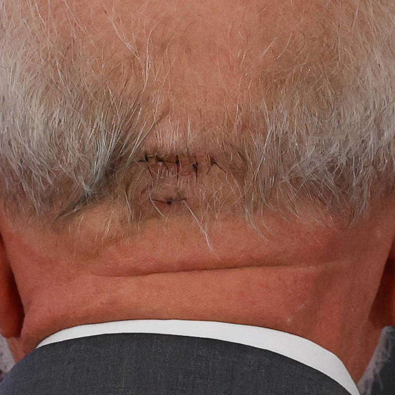 JFreiress_'s tweet image. O Lula partiu a cabeça em uma queda no banheiro e ninguém viu a Janja ou aliados do Lula fazendo esse mimimi que os bolsonaristas estão fazendo por causa de uma batidinha de cabeça do Bolsonaro. Pelo contrário, eles estavam tirando sarro e torcendo para que o Lula moresse.