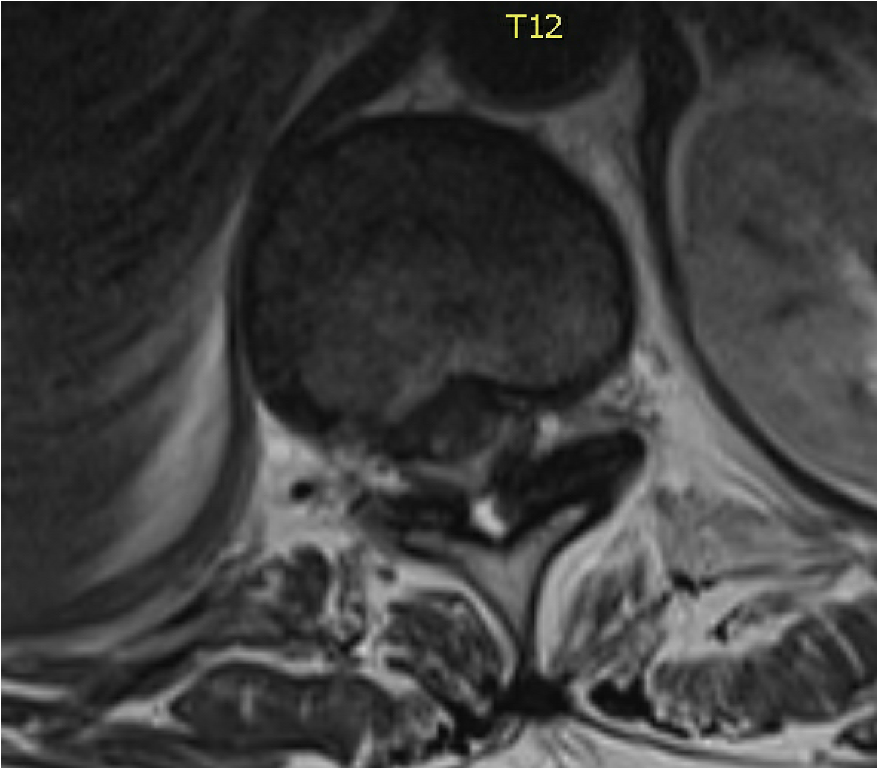 Michael Yang, MD MSc FRCSC tweet media