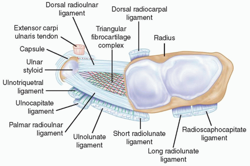 NickIlic_Physio's tweet image. Q: “How do you manage #TFCC injuries?”

My usual response: “How do you know it’s TFCC?”

Confirmed TFCC tears are rare. MRI often isn't clear.
The specific "TFCC" diagnosis usually doesn’t change management, but it can be nocebic vs "Ulnar Wrist Pain".

🔗 nickilicphysio.substack.com/p/clinicians-c…