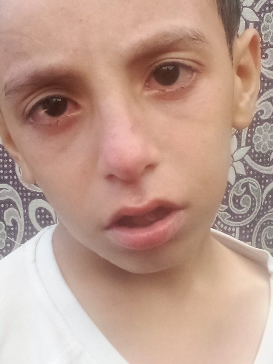 RozeatG's tweet image. My orphaned children don’t ask for much — just warmth in the cold, food to ease their hunger, and a kind hand to help. With no one to support them but me, I’m struggling alone. Every bit of help brings hope.
 
Comment, even if it's just a dot. 💔💔
chuffed.org/project/137260…