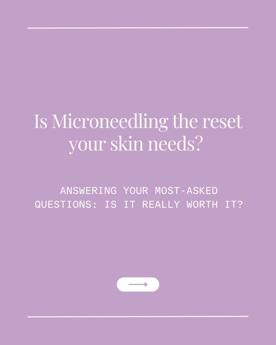 SkinSolutionsD's tweet image. Is Microneedling really worth it? Let’s talk about the results. 

Check out our blog post for the full breakdown! bit.ly/45HTIg2

#Microneedling #SkinTexture #AcneScars #NewYearNewSkin #EstheticianTips