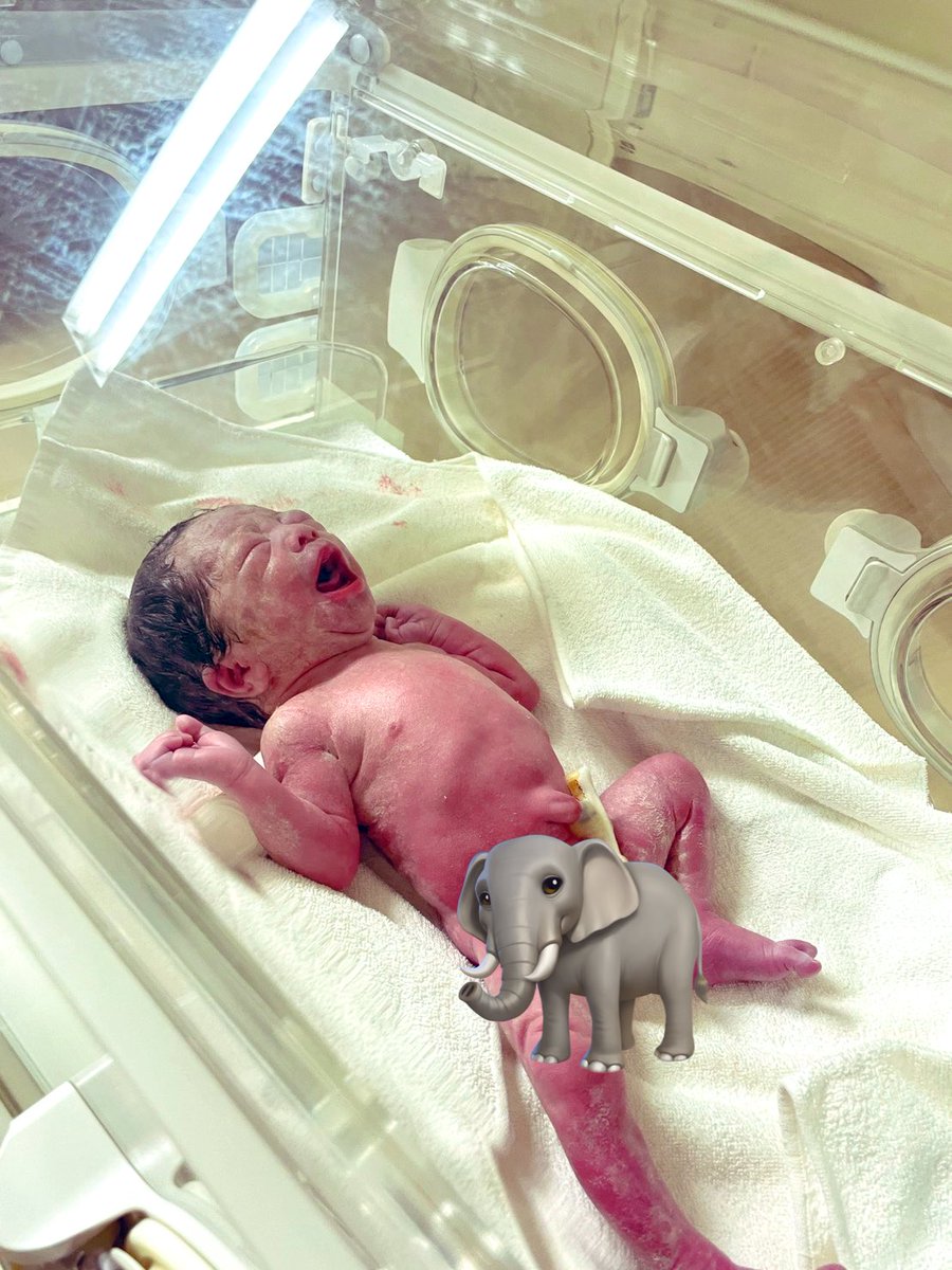 mto_c_'s tweet photo. R8.1.5
一卵性双生児の男の子出産しました
36w0dでの出産となり赤子たちはNICUへ
NICUへ面会に行くとずっと見てられる
可愛くて可愛くて、たまらん🥺
生まれてきてくれて、ありがとう🫶🫶 https://t.co/wz720GAxec