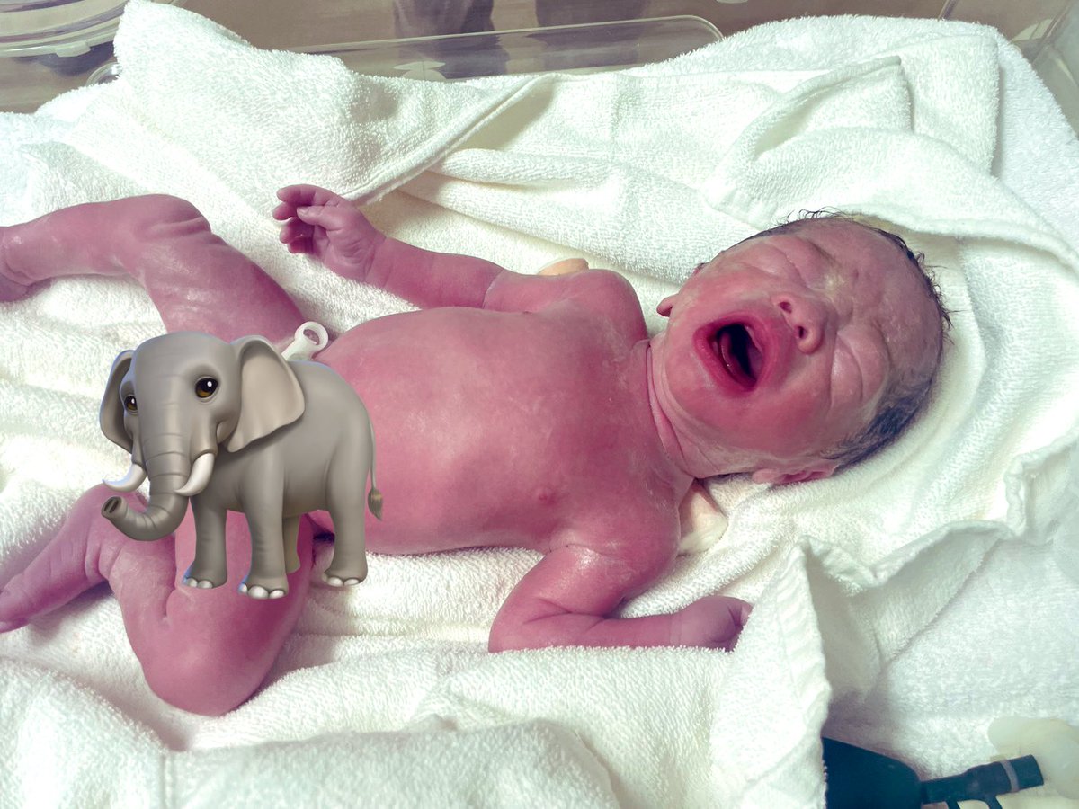 mto_c_'s tweet photo. R8.1.5
一卵性双生児の男の子出産しました
36w0dでの出産となり赤子たちはNICUへ
NICUへ面会に行くとずっと見てられる
可愛くて可愛くて、たまらん🥺
生まれてきてくれて、ありがとう🫶🫶 https://t.co/wz720GAxec