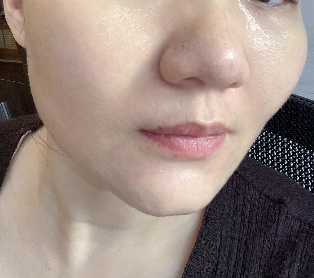 meauwww11's tweet image. Thanks to dr. Tompi &amp;amp; para warga

dlu gak kepikiran beli krn ngerasa mahal, skrng malah yg bikin kulitku pulih stelah trauma skincare hype.

sejak konsisten basic skincare ini, aku brhenti FOMO skincare hype
herannya malah lbh hemat

Micelar water: Wardah 
Face wash: Cetaphil
…