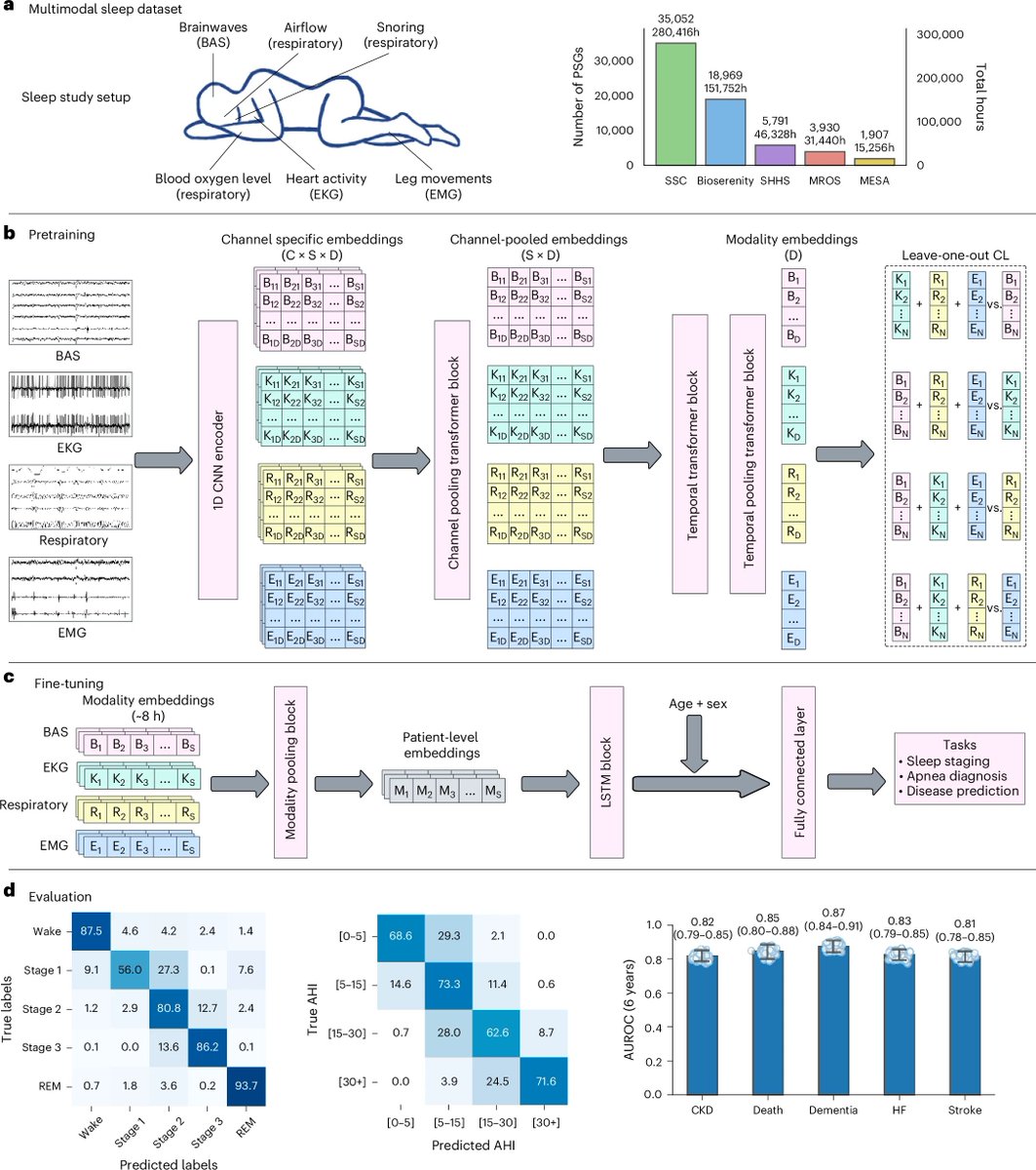bensmithlive's tweet image. A single night of sleep can now predict 130 future diseases with up to 93% accuracy.

Stanford researchers just released SleepFM.

This is a multimodal foundation model trained on 585,000 hours of physiological data from 65,000 participants.

And it's actually insane: (1/5)