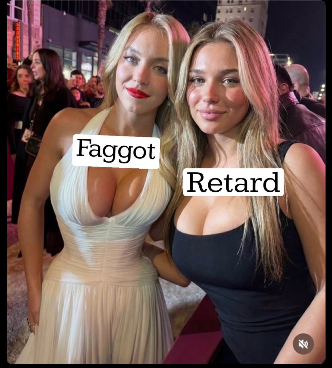 Your brain when trying to compose a clever response to a disagreement