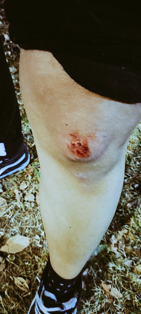 chinada92's tweet photo. Los reyes me trajeron otra rodilla sobre la rodilla. Excelente servicio https://t.co/x4sAGSWTDk