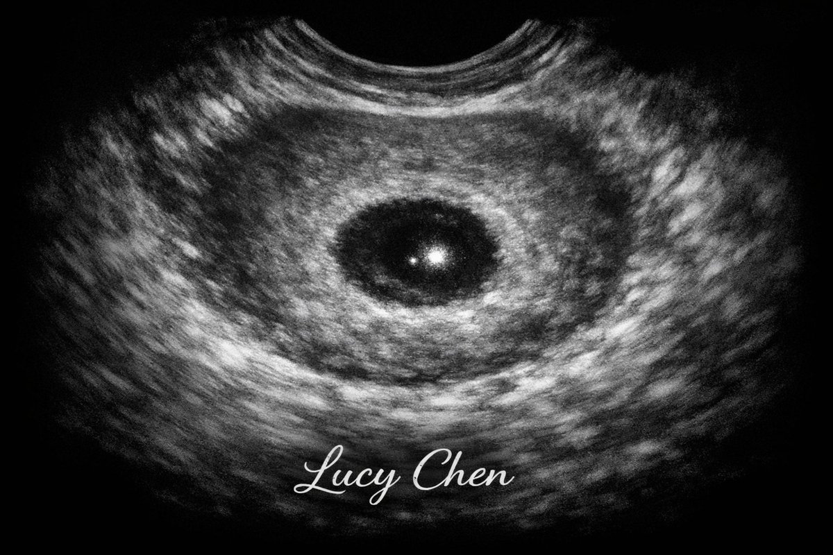 0FCHENLU's tweet image. ᅠ
         📷 𝑃𝑜𝑠𝑡 𝑖𝑛𝑠𝑡𝑎𝑔𝑟𝑎𝑚 
                
     𝐏𝐫𝐞𝐦𝐢𝐞̀𝐫𝐞 𝐞𝐜𝐡𝐨 𝐝𝐞 𝐧𝐨𝐭𝐫𝐞 𝐚𝐦𝐨𝐮𝐫 🤰🏻🩶
        
        #𝙸𝙽𝚂𝚃𝙰𝙽𝚃𝙿𝚁𝙴𝚂𝙴𝙽𝚃