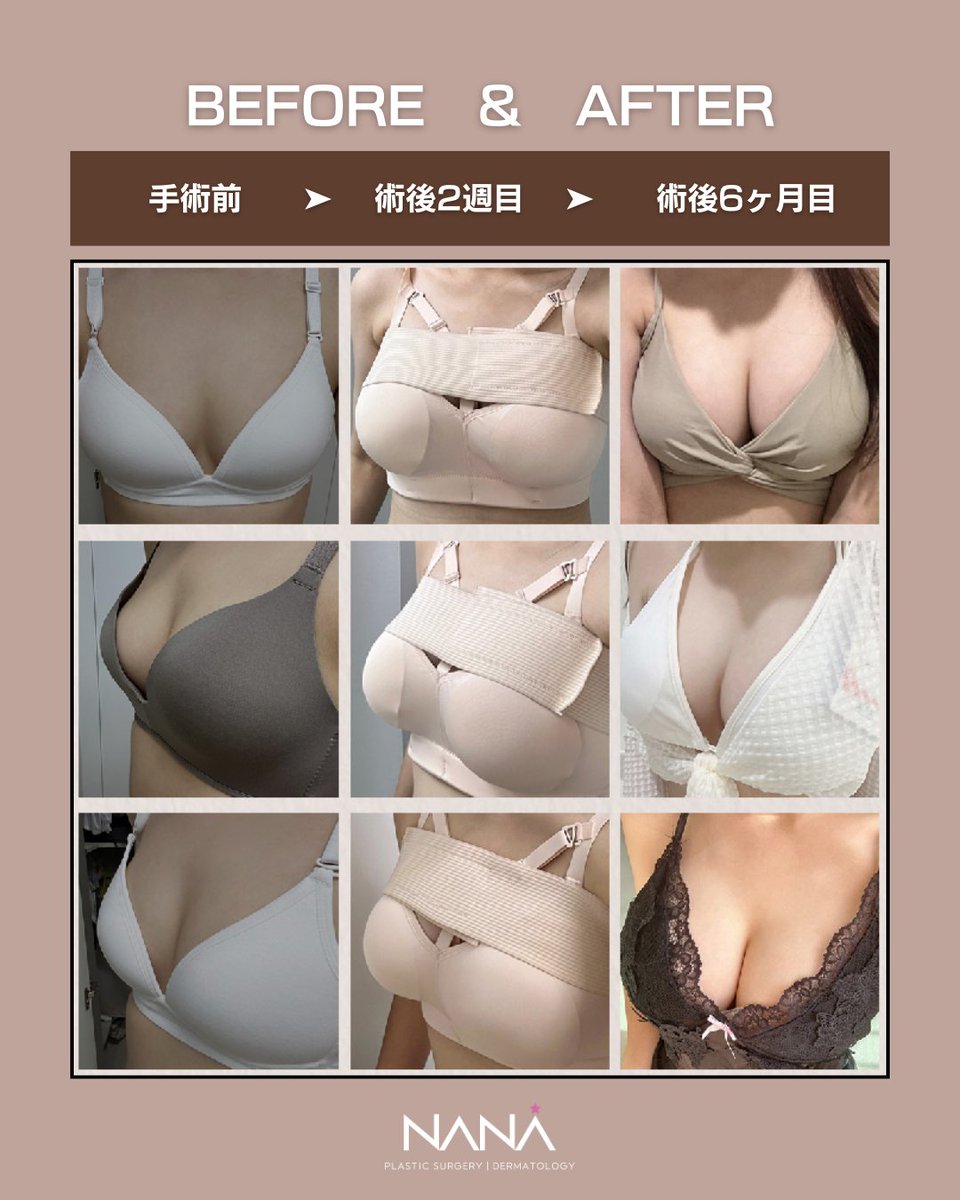 揺るぎない実績、選ばれ続ける理由があります🥇 【韓国豊胸といえば