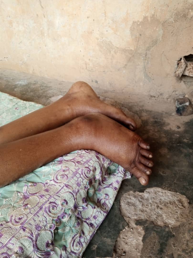 ayanfetiana's tweet image. URGENT MEDICAL SUPPORT NEEDED
We are seeking urgent help and prayers for our Auntie who has been diagnosed with kidney complications. Her condition has worsened. 
Every support will go directly toward her medical care. The amount needed is 5Million😭