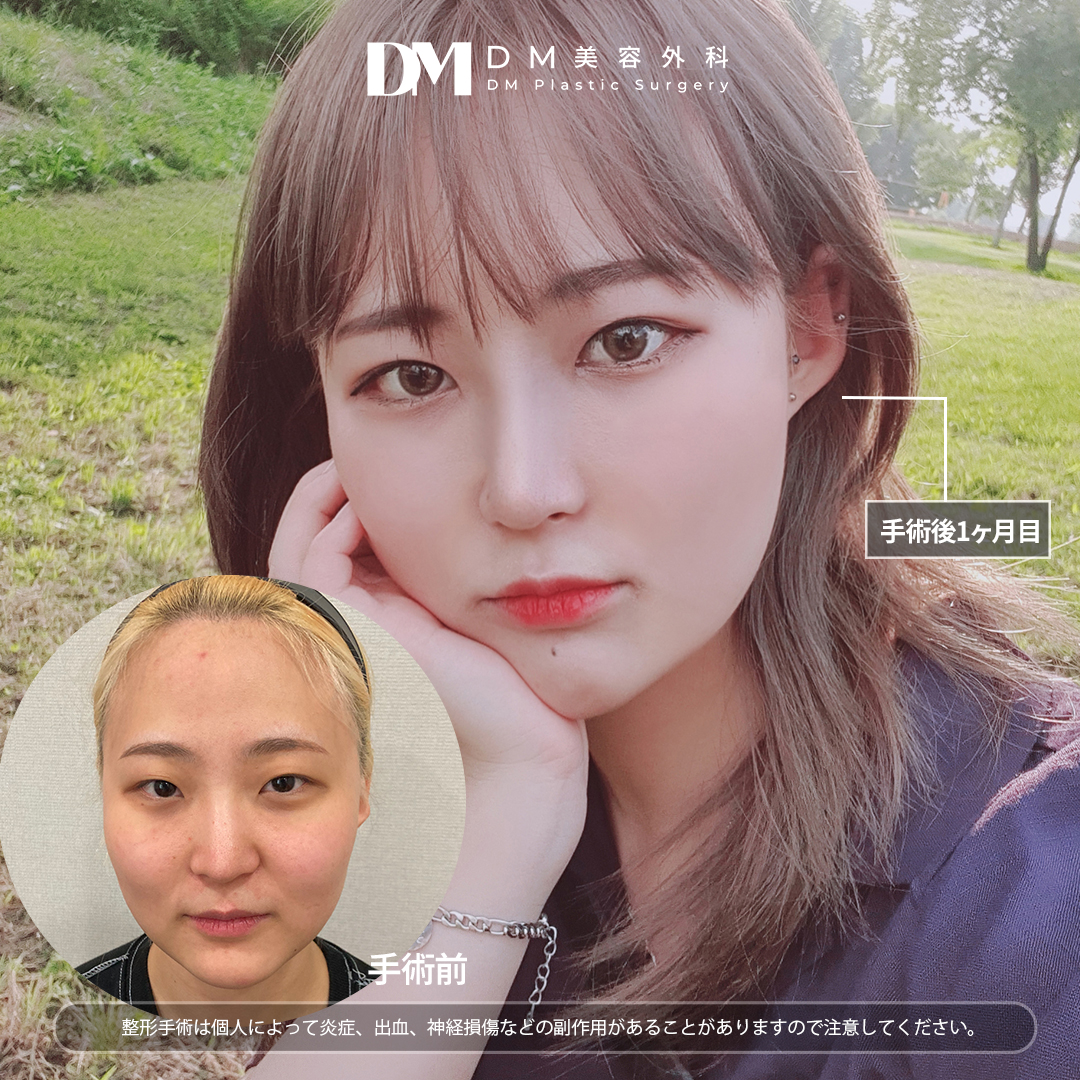 整形と美容の変化についての考察 | TikTok, image size:1080x1080