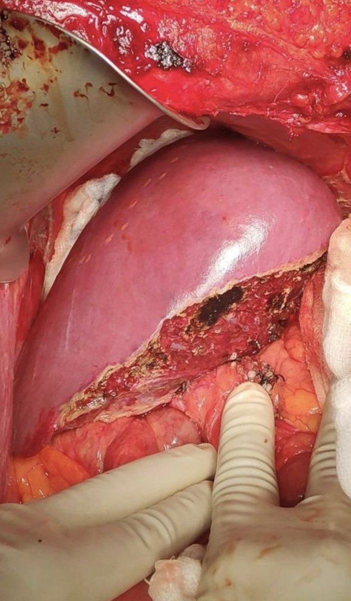 TheLiverDoc™ tweet media