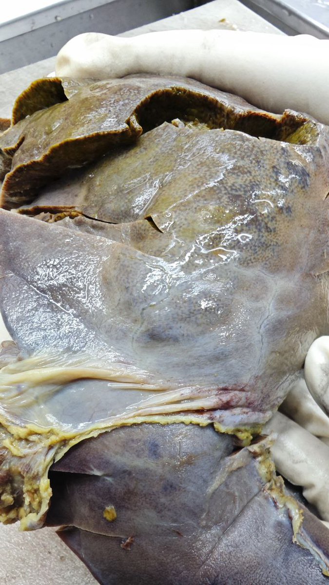 TheLiverDoc™ tweet media