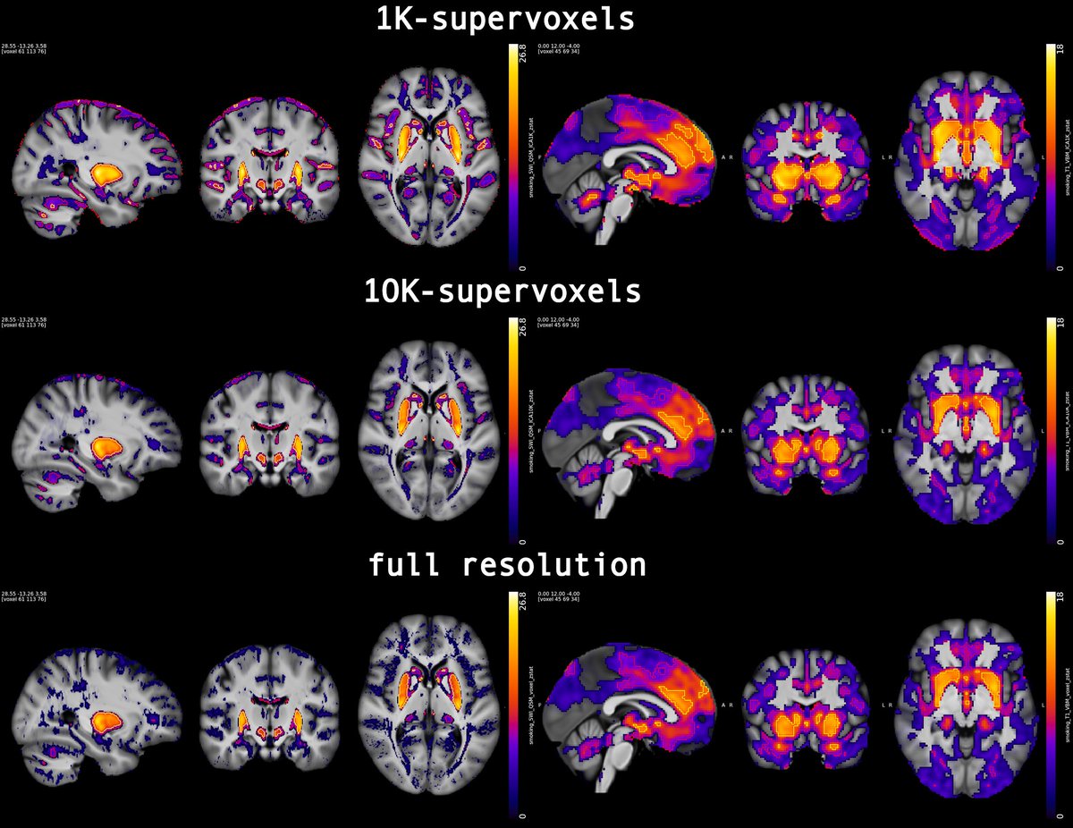 PANDORA is out 🧠⚡️
Run your high-res population (>80K) multimodal MRI study — now

▲ 98 mods
▲ speed/power/RAM wins🚀
▲ New supervoxels

Super easy with your var of choice

preprint with <a href="/fmrib_steve/">Stephen Smith</a> et al. (<a href="/OxfordCIN/">Oxford Centre for Integrative Neuroimaging</a>): medrxiv.org/content/10.648…

start: open.oxcin.ox.ac.uk/pages/pandora/…