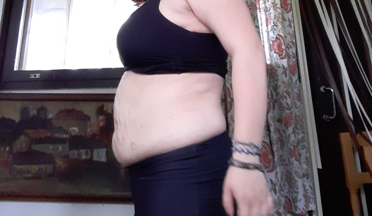 frankisdying420's tweet image. in six months,a lot can change. Only if you want to tho. Bmi 30-Bmi 25. Its been rough but im still loosing and fighting so i one day will be skinny